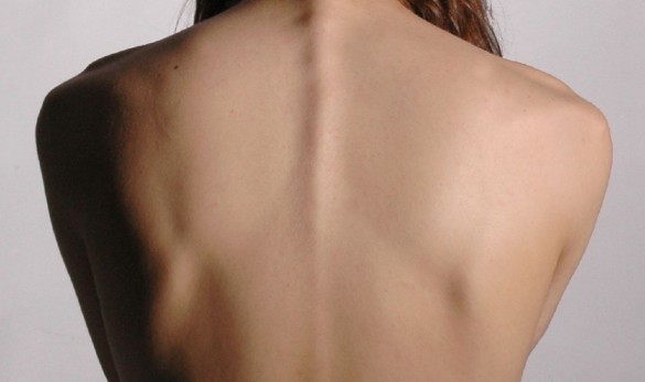 על יוגה וכאבי גב